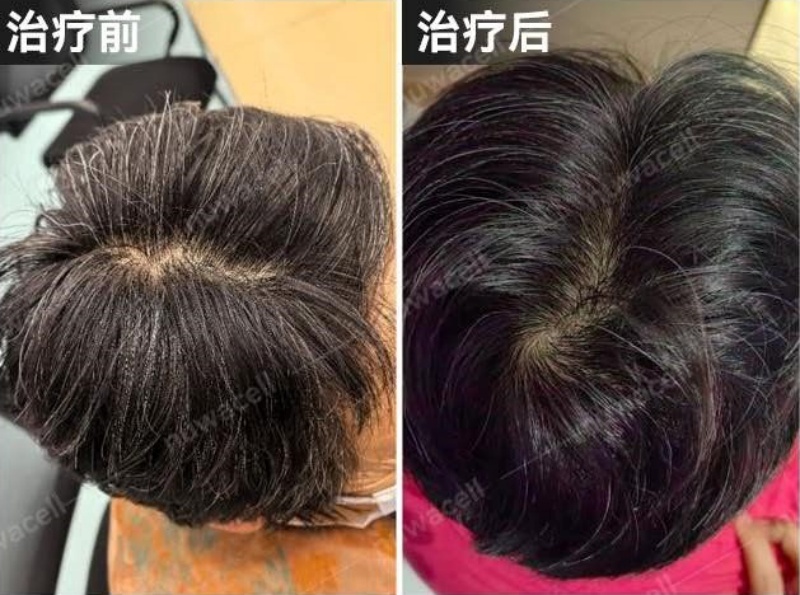 覆盖三大医学领域,中盛溯源多项iPSC研究成果亮相亚太CGT盛会